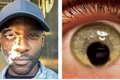 Ci ludzie wiedzą co to znaczy być unikatowym. Natura uczyniła ich wyjątkowymi