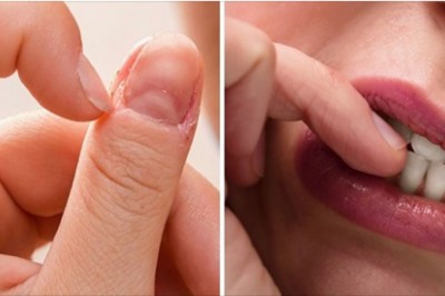 5 rzeczy, które obgryzanie paznokci może zdradzić na twój temat