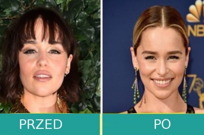 Te gwiazdy zmieniły jeden szczegół w swoim wyglądzie i znacząco na tym zyskały