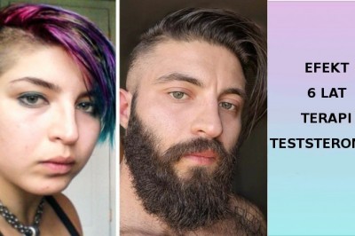 18 zdjęć, które pokazują piękno i moc prawdziwej przemiany