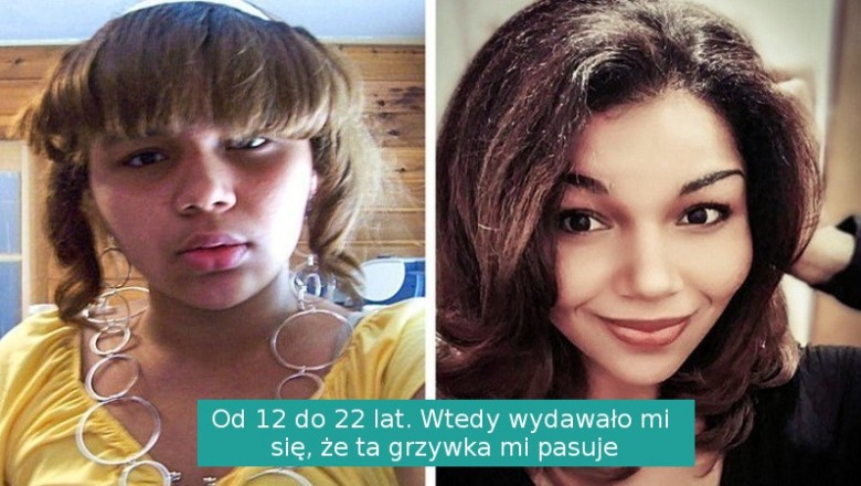 16 osób, które wraz z wiekiem przeszły ogromną metamorfozę na plus