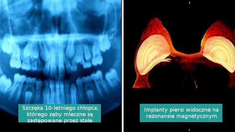 15 niezwykłych zdjęć wnętrza ludzkiego ciała, których nie widzimy na co dzień