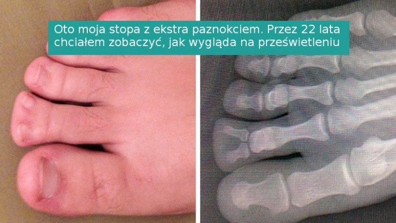 16 osób, które niespodziewanie napotkały na swojej drodze coś wyjątkowego