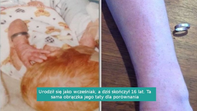 17 zdjęć pokazujących nieubłagany upływ czasu i to jak nas zmienia 