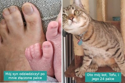 15 zdjęć pokazujących, że odmienność to supermoc, której nie trzeba się wstydzić