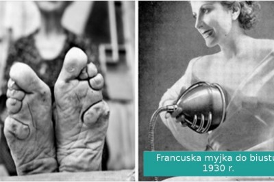 16 dziwacznych rzeczy, które dawniej  kobiety robiły w imię piękna