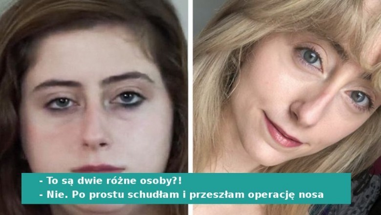 17 osób, które zmieniły się tak bardzo, że ledwo same rozpoznają się w lustrze