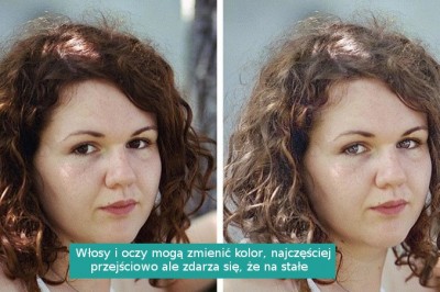  8 zmian zachodzących w ciele kobiety po urodzeniu dziecka. Niektóre negatywne