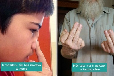 Cechy genetyczne tych ludzi należą do naprawdę wyjątkowych i rzadkich