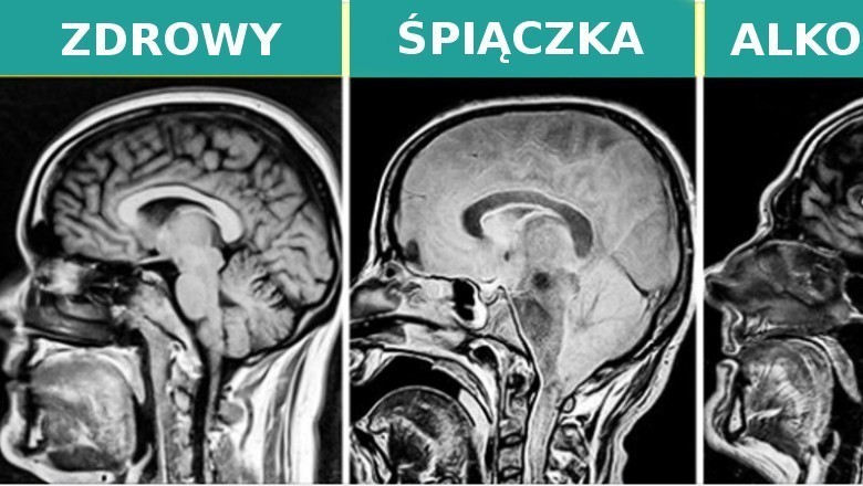 16 zdjęć rentgenowskich, które pokazują więcej niż książki do anatomii