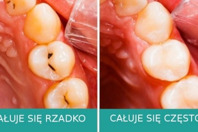 7 zmian, które zachodzą w twoim ciele w czasie pocałunku