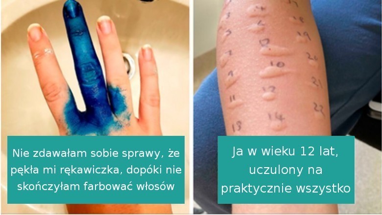 18 osób, które prawdopodobnie miały gorszy dzień od ciebie. Tak wygląda pech