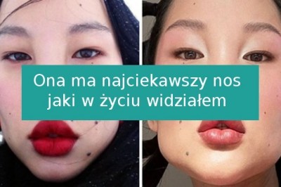 15 unikalnych osób, które urodziły się z z niezwykłymi cechami fizycznymi