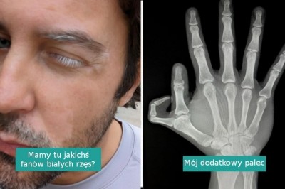 16 osób i zwierząt o niecodziennych cechach wyglądu