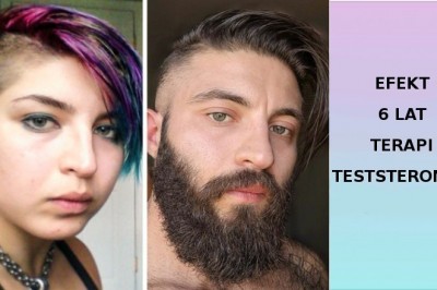 18 fotografii, które pokazują moc i piękno prawdziwej przemiany