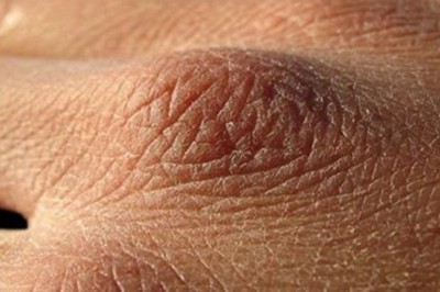 Możesz spożywać zbyt mało płynów. Oto 8 typowych objawów pokazujących, że pijesz za mało wody