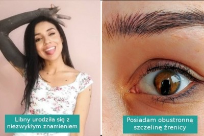 15 fotografii pokazujących, że piękno nie wymaga wcale perfekcji ani ideału