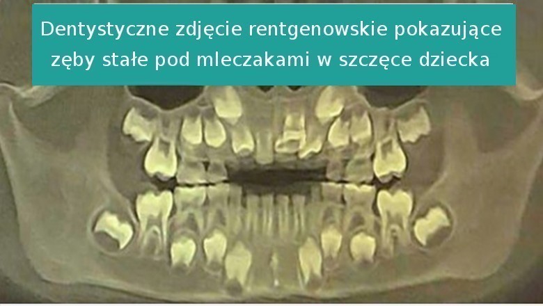 14 zdjęć rentgenowskich odkrywających niewidzianą stronę naszego świata