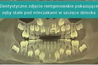 14 zdjęć rentgenowskich odkrywających niewidzianą stronę naszego świata
