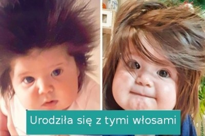 18 osób, które otrzymały interesujące dary od natury i zaskakują wyglądem