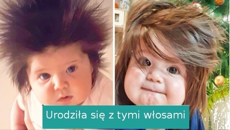 18 osób, które otrzymały niecodzienne dary od natury i zaskakują wyglądem